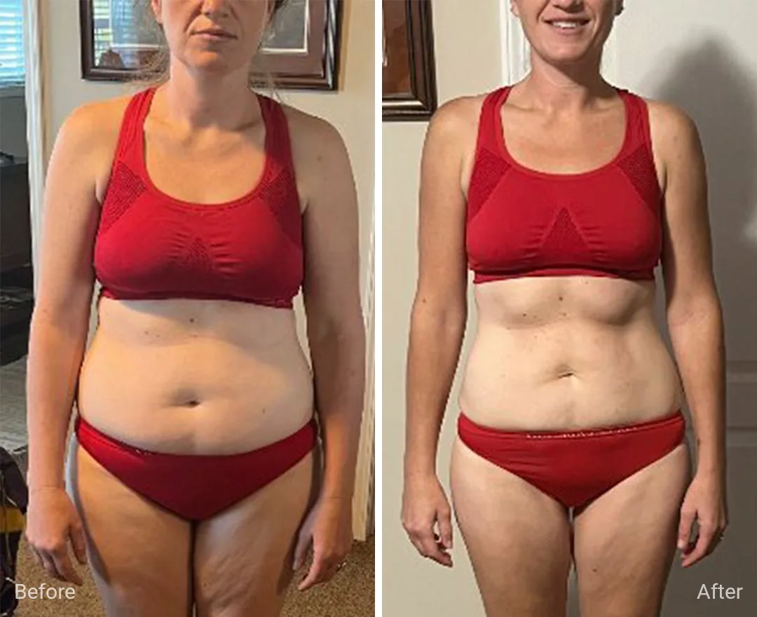 Client before and after — result 5