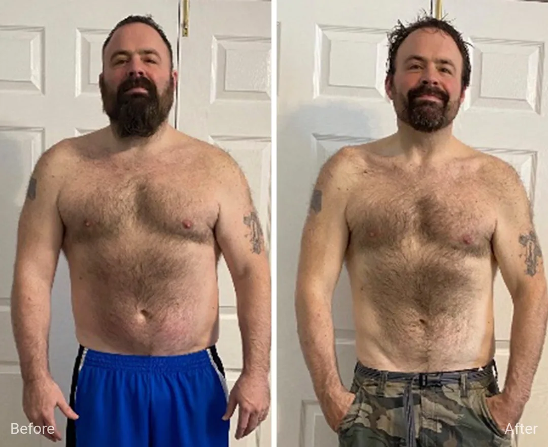 Client before and after — result 6