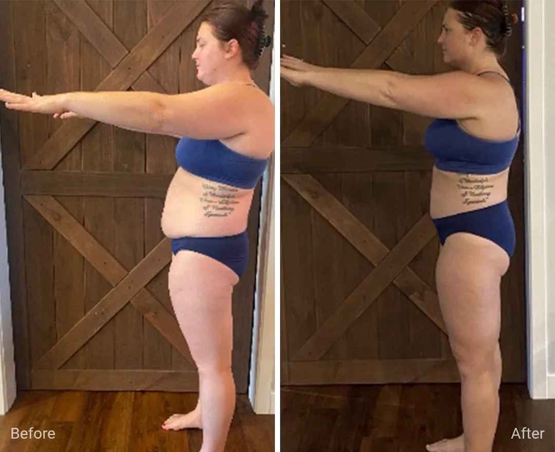 Client before and after — result 9